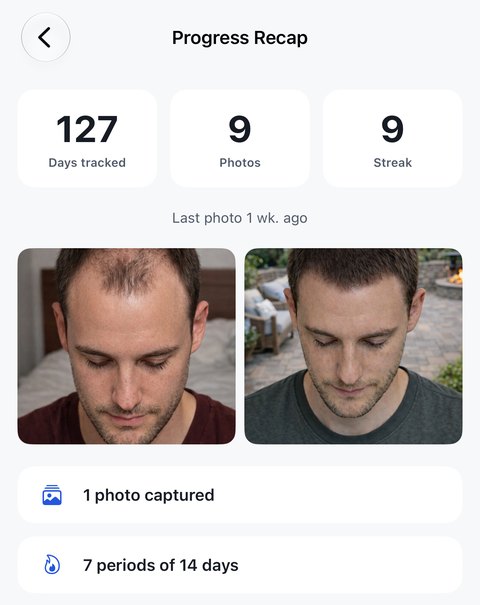 The Progress Recap screen: 127 days tracked, 9 photos and a streak of 9, the line Last photo 1 week ago, and the first and the latest photo of the project side by side, above two rows reading 1 photo captured and 7 periods of 14 days