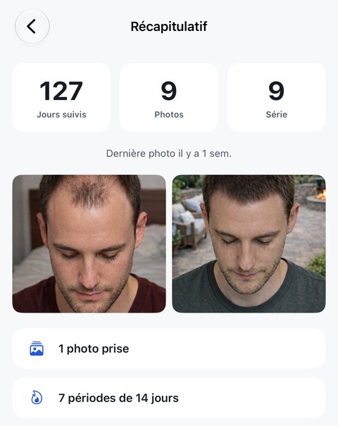 L'écran Récapitulatif&nbsp;: 127 jours suivis, 9 photos et une série de 9, la ligne Dernière photo il y a 1 semaine, puis la première photo du projet et la plus récente côte à côte, au-dessus de deux lignes indiquant 1 photo prise et 7 périodes de 14 jours